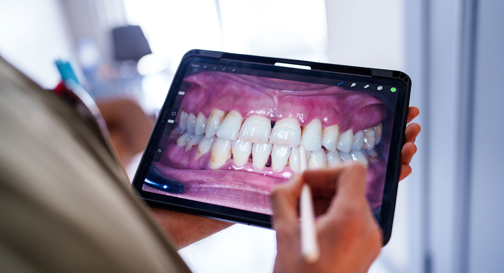 Blick über die Schulter eines Mitarbeiters des Gesundheitswesens, der ein zahnmedizinisches Bild auf einem digitalen Tablet prüft.