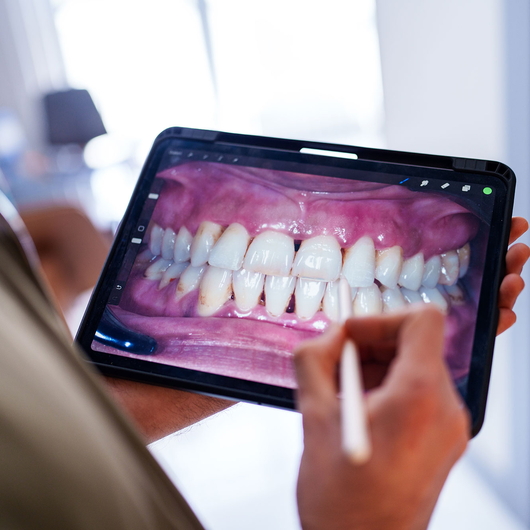 Blick über die Schulter eines Mitarbeiters des Gesundheitswesens, der ein zahnmedizinisches Bild auf einem digitalen Tablet prüft.